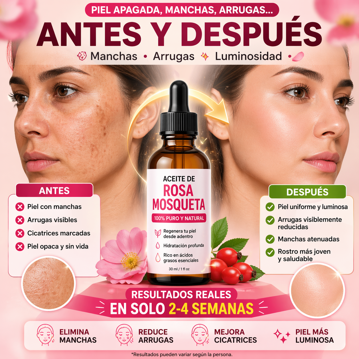 RoseSkin™ Aceite de Rosa Mosqueta 2x1 Adiós manchas.