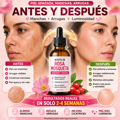 RoseSkin™ Aceite de Rosa Mosqueta 2x1 Adiós manchas.