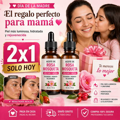 RoseSkin™ Aceite de Rosa Mosqueta 2x1 Adiós manchas.